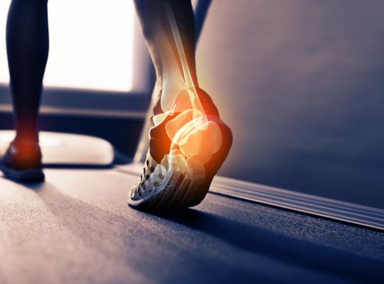 heel pain in active person